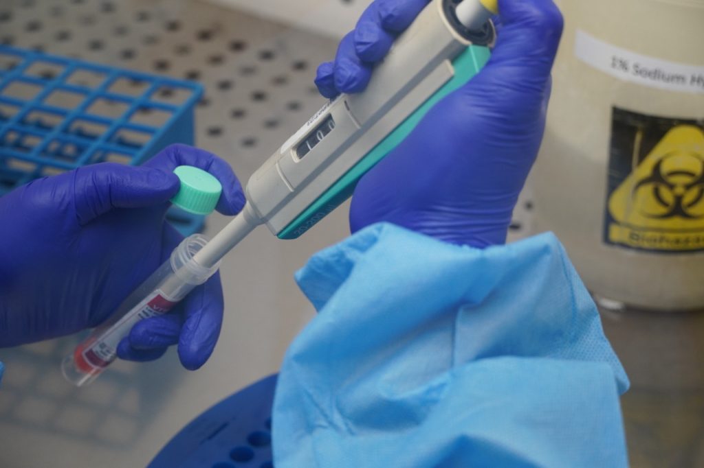 molecular laboratory at Narayana Nethralaya