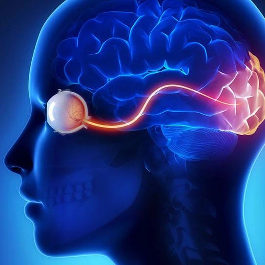 CVI understanding