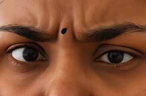 Eye Motility Disorders